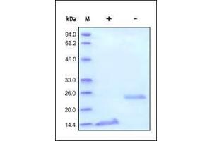 Human TGF-Beta 1 on SDS-PAGE under reducing (R) and no-reducing (NR) conditions. (TGFB1 Protein (AA 279-390))