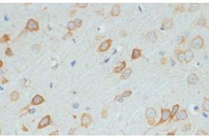 Immunohistochemistry of paraffin-embedded Rat brain using DDX3X Polyclonal Antibody at dilution of 1:100 (40x lens). (DDX3X Antikörper)