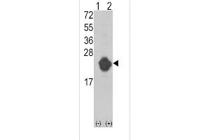 Western blot analysis of IL1RN (arrow) using rabbit polyclonal IL1RN Antibody (Center) (ABIN390396 and ABIN2840788). (IL1RN Antikörper  (AA 100-129))