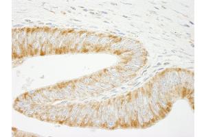 anti-Inositol Polyphosphate Phosphatase-Like 1 (INPPL1) (AA 100-150) antibody