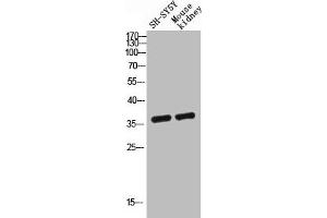 Western blot analysis of SH-SY5Y mouse-kidney lysis using GPR119 antibody. (G Protein-Coupled Receptor 119 Antikörper  (Internal Region))