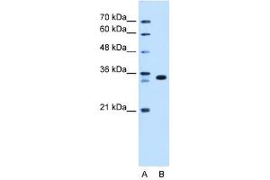 Western Blot showing ARGFX antibody used at a concentration of 1-2 ug/ml to detect its target protein. (ARGFX Antikörper  (N-Term))