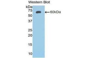 Western Blotting (WB) image for anti-Insulin-Like Growth Factor Binding Protein 2, 36kDa (IGFBP2) (AA 24-305) antibody (ABIN1172088) (IGFBP2 Antikörper  (AA 24-305))