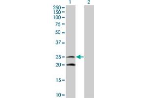 Western Blot analysis of IL6 expression in transfected 293T cell line by IL6 monoclonal antibody (M08), clone 2C5. (IL-6 Antikörper  (AA 29-212))