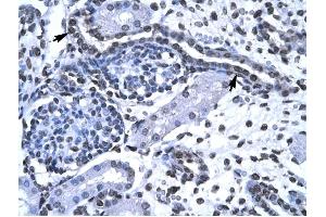 FOXG1A antibody was used for immunohistochemistry at a concentration of 4-8 ug/ml to stain Epithelial cells of renal tubule (arrows) in Human Kidney.