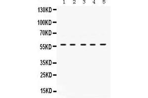 Anti- Lck Picoband antibody, Western blottingAll lanes: Anti Lck  at 0.