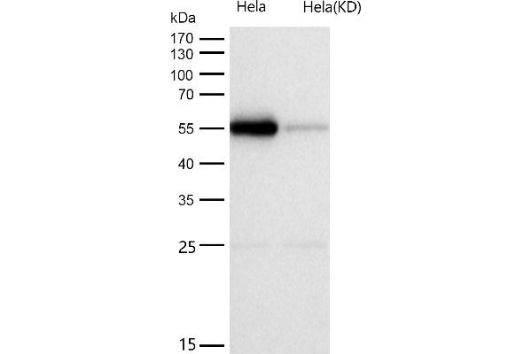 Rekombinanter Primary Retinal Dysplasia (PRD) Antikörper