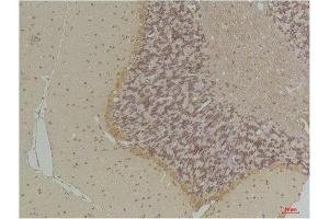 Immunohistochemistry (IHC) analysis of paraffin-embedded Rat Brain Tissue using GABA Transporter 1 Rabbit Polyclonal Antibody diluted at 1:200. (SLC6A1 Antikörper)
