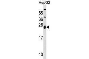 ZNRF1 Antibody (Center) western blot analysis in HepG2 cell line lysates (35 µg/lane). (ZNRF1 Antikörper  (Middle Region))