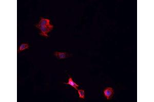 ABIN6266742 staining Hek293 cells by IF/ICC. (TNFRSF1B Antikörper  (C-Term))