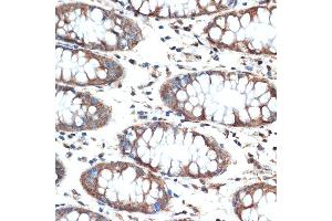 Immunohistochemistry of paraffin-embedded human colon using MUC4 Rabbit mAb (ABIN7268692) at dilution of 1:100 (40x lens). (MUC4 Antikörper)