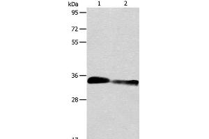 Western Blot analysis of Mouse kidney and Rat kidney tissue using ACY3 Polyclonal Antibody at dilution of 1:750 (Aminoacylase 3 Antikörper)