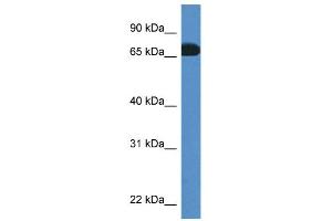 WB Suggested Anti-Pros1 Antibody Titration: 1. (PROS1 Antikörper  (C-Term))