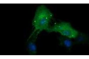 Image no. 3 for anti-Cancer/testis Antigen 1B (CTAG1B) antibody (ABIN1499890) (CTAG1B Antikörper)