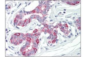 Human Breast: Formalin-Fixed, Paraffin-Embedded (FFPE) (PKMYT1 Antikörper  (Internal Region))