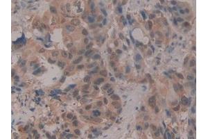Immunohistochemistry (IHC) image for anti-Cold Inducible RNA Binding Protein (CIRBP) (AA 1-172) antibody (ABIN7442150)