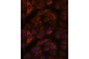 Immunofluorescence analysis of U-2 OS cells using HEBP2 antibody (ABIN7267604) at dilution of 1:100. (HEBP2 Antikörper  (AA 1-205))