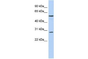 WB Suggested Anti-PRRC1 Antibody Titration: 0. (PRRC1 Antikörper  (Middle Region))