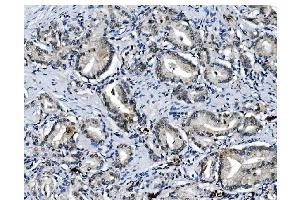 IHC analysis of PCBP1 using anti-PCBP1 antibody (ABIN7600127).