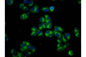 Immunofluorescence staining of Hela cells with ABIN7164887 at 1:66, counter-stained with DAPI. (PTOV1 Antikörper  (AA 2-137))