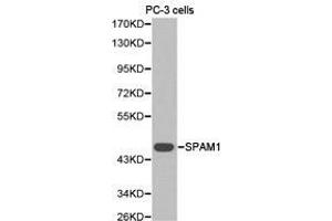 Western Blotting (WB) image for anti-Sperm Adhesion Molecule 1 (PH-20 Hyaluronidase, Zona Pellucida Binding) (SPAM1) antibody (ABIN1874917)