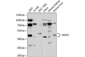 Western blot analysis of extracts of various cell lines, using WISP1 antibody (ABIN1683290, ABIN3017735, ABIN3017736 and ABIN6220223) at 1:1000 dilution. (WISP1 Antikörper  (AA 158-367))