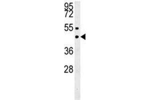 SUV39H1 western blot analysis in MDA-MB435 lysate. (SUV39H1 Antikörper  (N-Term))