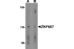 Western blot analysis of ZNF687 in Jurkat cell lysate with ZNF687 antibody at 0. (ZNF687 Antikörper  (C-Term))