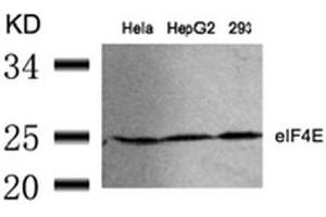Image no. 3 for anti-Eukaryotic Translation Initiation Factor 4E (EIF4E) (Ser209) antibody (ABIN197473) (EIF4E Antikörper  (Ser209))