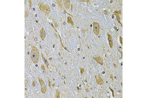 Immunohistochemistry of paraffin-embedded mouse brain using ITGA2 Antibody (ABIN5974459) at dilution of 1/100 (40x lens). (ITGA2 Antikörper)