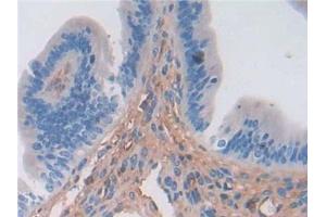 Detection of a1ACT in Mouse Uterus Tissue using Polyclonal Antibody to Alpha-1-Antichymotrypsin (a1ACT) (SERPINA3 Antikörper  (AA 23-253))