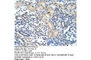 Rabbit Anti-WBSCR1 Antibody  Paraffin Embedded Tissue: Human Kidney Cellular Data: Epithelial cells of renal tubule Antibody Concentration: 4. (EIF4H Antikörper  (Middle Region))