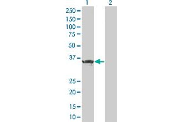ZBTB32 antibody  (AA 1-302)