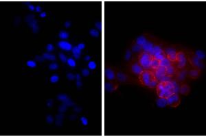 Human epithelial carcinoma cell line HEp-2 was stained with Mouse Anti-Human CD44-UNLB and DAPI. (Ziege anti-Maus Ig (Heavy & Light Chain) Antikörper (beta-Gal))