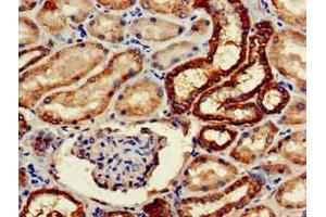 Immunohistochemistry of paraffin-embedded human kidney tissue using ABIN7161126 at dilution of 1:100 (WWP2 Antikörper  (AA 145-367))