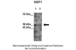 Western Blotting (WB) image for anti-Nuclear RNA Export Factor 1 (NXF1) (N-Term) antibody (ABIN2778977)