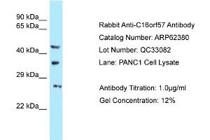 Western Blotting (WB) image for anti-U6 SnRNA Biogenesis 1 (USB1) (C-Term) antibody (ABIN2789122) (C16orf57 Antikörper  (C-Term))