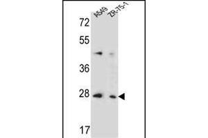 T4S4 Antibody (N-term) (ABIN653705 and ABIN2843022) western blot analysis in A549,ZR-75-1 cell line lysates (35 μg/lane). (TM4SF4 Antikörper  (N-Term))