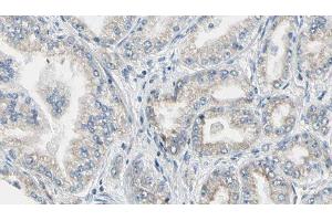 ABIN6276867 at 1/100 staining Human prostate tissue by IHC-P. (FTL Antikörper  (C-Term))