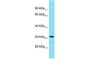 Host: Rabbit Target Name: ADPRHL1 Sample Type: RPMI-8226 Whole Cell lysates Antibody Dilution: 1. (ADPRHL1 Antikörper  (Middle Region))