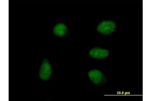 Immunofluorescence of purified MaxPab antibody to DPPA4 on HeLa cell. (DPPA4 Antikörper  (AA 1-304))