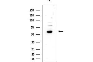 Western blot analysis of lysates from EC304 cells, using TLS/FUS Antibody at 1/1000 dilution.