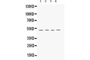 Anti- Keratocan Picoband antibody, Western blottingAll lanes: Anti Keratocan  at 0. (KERA Antikörper  (C-Term))