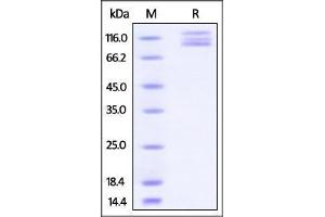 SDS-PAGE (SDS) image for Integrin alpha V, Integrin beta 3 (ITGAV/ITGB3) (AA 31-992) (Active) protein (His tag) (ABIN2870663)