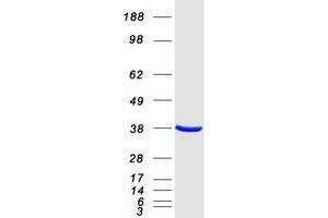 Western Blotting (WB) image for Aryl Hydrocarbon Receptor Interacting Protein (AIP) protein (Myc-DYKDDDDK Tag) (ABIN2714488)