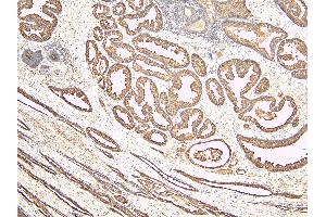 ABIN190842 (6µg/ml) staining of paraffin embedded Human Prostate. (Kallikrein 2 Antikörper  (Internal Region))