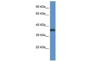 Western Blot showing PIGC antibody used at a concentration of 1 ug/ml against Fetal Lung Lysate (PIGC Antikörper  (C-Term))