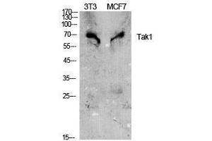 Western Blotting (WB) image for anti-Nuclear Receptor Subfamily 2, Group C, Member 2 (NR2C2) (Tyr142) antibody (ABIN6281169)