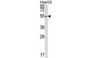 Western Blotting (WB) image for anti-Cleavage and Polyadenylation Factor I Subunit 1 (CLP1) antibody (ABIN2999240) (CLP1 Antikörper)