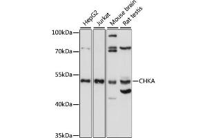 Western blot analysis of extracts of various cell lines, using CHKA antibody (ABIN7266342) at 1:1000 dilution. (Choline Kinase alpha Antikörper  (AA 1-170))